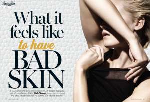 BEAUTY - SPOTS_ R1 (PDF Spread)_Page_1